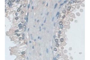 Immunohistochemistry (IHC) image for anti-Myosin Heavy Chain 7, Cardiac Muscle, beta (MYH7) (AA 26-309) antibody (ABIN7440755)