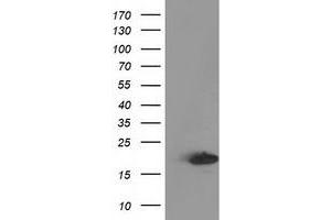 Western Blotting (WB) image for anti-Destrin (Actin Depolymerizing Factor) (DSTN) antibody (ABIN1497909) (Destrin Antikörper)