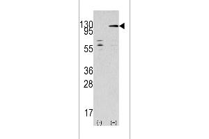 Western blot analysis of TAOK3 using rabbit polyclonal TAOK3 Antibody using 293 cell lysates (2 ug/lane) either nontransfected (Lane 1) or transiently transfected with the TAOK3 gene (Lane 2). (TAO Kinase 3 Antikörper  (C-Term))