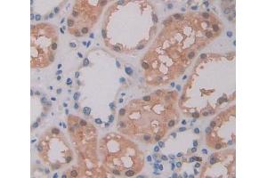 IHC-P analysis of kidney tissue, with DAB staining.