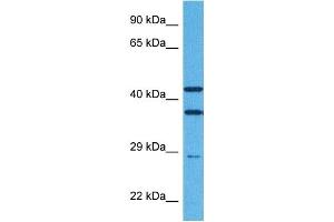 Host:  Rabbit  Target Name:  TREM2  Sample Tissue:  Human Jurkat Whole Cell  Antibody Dilution:  1ug/ml (TREM2 Antikörper  (Middle Region))
