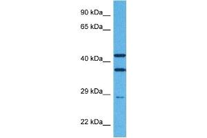 Host:  Rabbit  Target Name:  TREM2  Sample Tissue:  Human Jurkat Whole Cell  Antibody Dilution:  1ug/ml