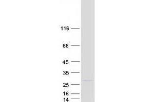 Western Blotting (WB) image for Peroxisome Biogenesis Factor 11 gamma (PEX11G) protein (Myc-DYKDDDDK Tag) (ABIN2728689)