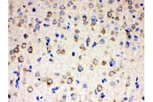 Anti- ULK3 Picoband antibody, IHC(P) IHC(P): Rat Brain Tissue (ULK3 Antikörper  (C-Term))