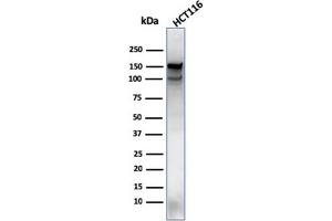 Western Blot Analysis of HCT116 cell lysate using MSH6 Mouse Monoclonal Antibody (MSH6/3089).