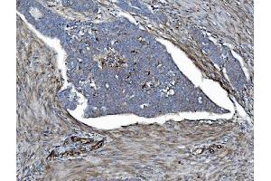 IHC analysis of EHD3 using anti-EHD3 antibody (ABIN7602777). (EHD3 Antikörper  (C-Term))