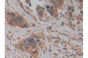 Used in DAB staining on fromalin fixed paraffin- embedded kidney tissue (PKM2 Antikörper  (AA 141-248))