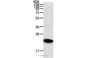 Western blot analysis of Human fetal brain tissue, using RHOC Polyclonal Antibody at dilution of 1:300 (RHOC Antikörper)