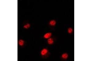 Immunofluorescent analysis of POLR3E staining in Hela cells. (POLR3E Antikörper)