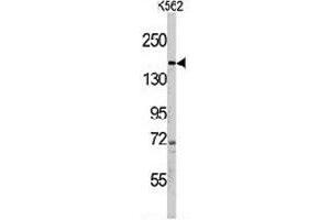 Western blot analysis of PHLPP1 polyclonal antibody  in K-562 cell line lysates (35 ug/lane). (PHLPP1 Antikörper  (N-Term))