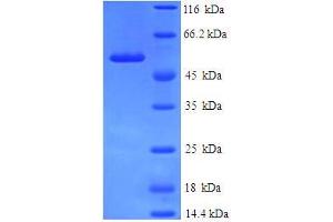 SDS-PAGE (SDS) image for Annexin A9 (ANXA9) (AA 8-345), (partial) protein (His-SUMO Tag) (ABIN5709047) (Annexin A9 Protein (ANXA9) (AA 8-345, partial) (His-SUMO Tag))