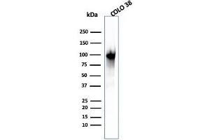 Western Blot Analysis of COLO-38 cell lysate using gp100 Mouse Monoclonal Antibody (PMEL/2039). (Melanoma gp100 Antikörper  (AA 376-502))