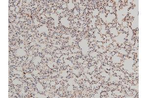 Immunohistochemistry (IHC) image for anti-LIM Domain Kinase 1 (LIMK1) (pThr508) antibody (ABIN6255701)