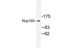 Image no. 1 for anti-Nucleoporin 160kDa (NUP160) antibody (ABIN317926) (NUP160 Antikörper)