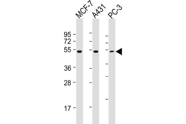 PPP2R5E Antikörper  (C-Term)