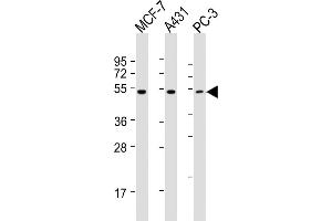 All lanes : Anti-P2R5E Antibody (C-term) at 1:2000 dilution Lane 1: MCF-7 whole cell lysates Lane 2: A431 whole cell lysates Lane 3: PC-3 whole cell lysates Lysates/proteins at 20 μg per lane. (PPP2R5E Antikörper  (C-Term))