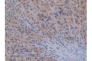 IHC-P analysis of Rat Stomach Tissue, with DAB staining. (STAT2 Antikörper  (AA 587-838))