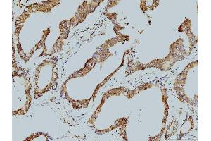 IHC analysis of LSM8 using anti-LSM8 antibody (ABIN7599578). (NAA38 Antikörper  (AA 1-96))