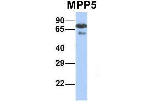 Host:  Rabbit  Target Name:  MPP5  Sample Type:  Human Fetal Lung  Antibody Dilution:  1. (MPP5 Antikörper  (N-Term))
