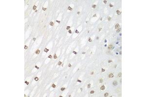 Immunohistochemistry of paraffin-embedded human esophagus using FOSL2 antibody at dilution of 1:100 (40x lens).
