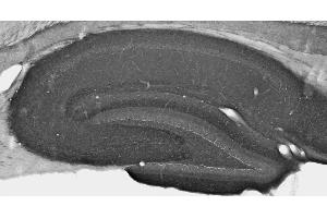 Adult rat hippocampus immunohistochemistry under standard protocol.