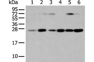 Western Blotting (WB) image for anti-Synaptosomal-Associated Protein, 23kDa (SNAP23) antibody (ABIN2424185) (SNAP23 Antikörper)