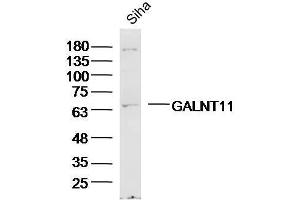 Siha Cell lysates probed with GALNT11/GalNAc-T11 Polyclonal Antibody, unconjugated  at 1:300 overnight at 4°C followed by a conjugated secondary antibody for 60 minutes at 37°C. (GALNT11 Antikörper  (AA 401-500))