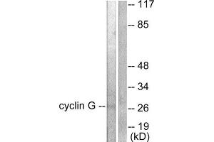 Western Blotting (WB) image for anti-Cyclin G1 (CCNG1) (Internal Region) antibody (ABIN1848500) (Cyclin G1 Antikörper  (Internal Region))