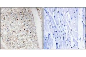 Immunohistochemistry analysis of paraffin-embedded human heart, using PKD1/2/3/PKC mu (Phospho-Ser738+Ser742) Antibody. (PKD1/2/3/PKC mu (AA 706-755), (pSer738) Antikörper)
