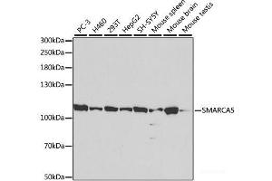 Western blot analysis of extracts of various cell lines using SMARCA5 Polyclonal Antibody at dilution of 1:1000. (SMARCA5 Antikörper)