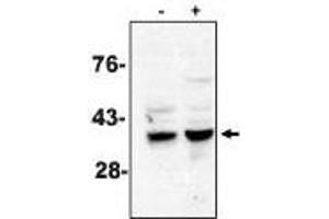 Western blot analysis using caspase-7 antibody on MCF-7 cells treated with thapsigargin for 48 hours which are negative (-) and positive (+) for caspase-3. (Caspase 7 Antikörper)