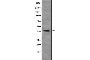 Western blot analysis of NEUROD6 expression in 293T whole cell lysate ,The lane on the left is treated with the antigen-specific peptide.