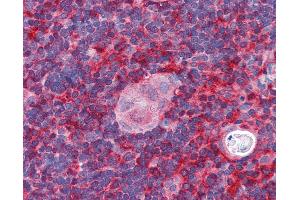 Anti-ARPC1B / p41-ARC antibody IHC of human thymus. (ARPC1B Antikörper  (AA 2-14))