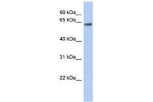 Image no. 1 for anti-TBC1 Domain Family, Member 10B (TBC1D10B) (AA 683-732) antibody (ABIN6742484) (TBC1D10B Antikörper  (AA 683-732))