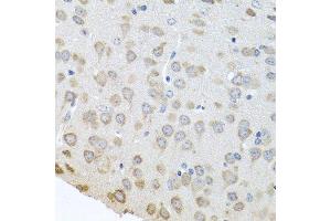 Immunohistochemistry (Paraffin-embedded Sections) (IHC (p)) image for anti-Poly(A) Binding Protein, Cytoplasmic 4 (Inducible Form) (PABPC4) (AA 350-450) antibody (ABIN6145149)