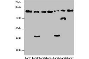 Western blot All lanes: ALB antibody at 2 μg/mL Lane 1: Mouse heart tissue Lane 2: Mouse liver tissue Lane 3: Mouse spleen tissue Lane 4: Mouse lung tissue Lane 5: Mouse kidney tissue Lane 6: Mouse brain tissue Lane 7: Mouse skeletal muscle tissue Secondary Goat polyclonal to rabbit IgG at 1/10000 dilution Predicted band size: 70, 48, 46 kDa Observed band size: 70, 50, 27 kDa (Albumin Antikörper  (AA 76-389))