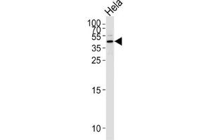Western Blotting (WB) image for anti-serpin Peptidase Inhibitor, Clade B (Ovalbumin), Member 5 (SERPINB5) antibody (ABIN2996527) (SERPINB5 Antikörper)