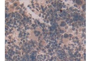 Detection of GLUD1 in Mouse Spleen Tissue using Polyclonal Antibody to Glutamate Dehydrogenase 1 (GLUD1)