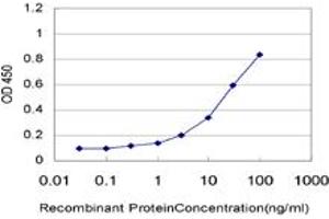 Detection limit for recombinant GST tagged UBE2Q2 is approximately 1ng/ml as a capture antibody. (UBE2Q2 Antikörper  (AA 1-110))