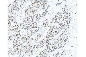 Immunohistochemistry (IHC) image for anti-Poly (ADP-Ribose) Polymerase 1 (PARP1) (AA 750-800) antibody (ABIN7449531)
