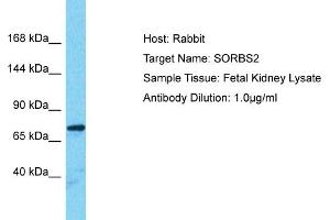 Host: Rabbit Target Name: SORBS2 Sample Type: Fetal Kidney lysates Antibody Dilution: 1. (Sorbs2 Antikörper  (Middle Region))