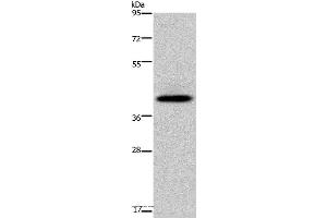 Western blot analysis of Human fetal liver tissue, using SERPINB3 Polyclonal Antibody at dilution of 1:200 (SERPINB3 Antikörper)