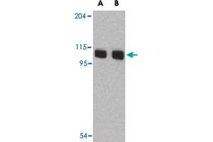 Western blot analysis of AOF2 in P815 cell lysate with AOF2 polyclonal antibody  at (A) 1 and (B) 2 ug/mL . (LSD1 Antikörper  (N-Term))