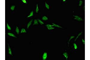 Immunofluorescent analysis of Hela cells using ABIN7170500 at dilution of 1:100 and Alexa Fluor 488-congugated AffiniPure Goat Anti-Rabbit IgG(H+L) (STRBP Antikörper  (AA 201-500))