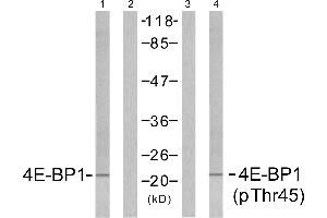 Western blot analysis of extracts from MDA435 cells untreated or treated with EGF (200nm, 5mins), using 4E-BP1 (Ab-45) antibody (Linand 2) and 4E-BP1 (phospho-Thr45) antibody (Line 3 and 4). (eIF4EBP1 Antikörper  (pThr45))