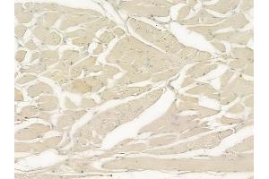 ABIN6258204 and ABIN6273883 at 1/100 staining human tongue carcinoma by IHC-P. (GPR56 Antikörper  (C-Term))