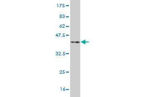 Western Blot detection against Immunogen (37. (NKX3-1 Antikörper  (AA 100-209))