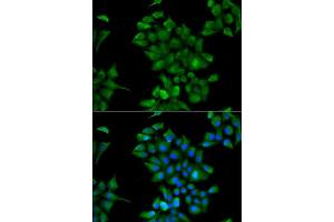 Immunofluorescence analysis of HeLa cells using CTNS antibody (ABIN5974151). (CTNS Antikörper)