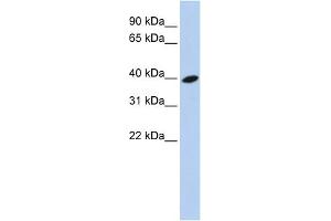 WB Suggested Anti-ARL13B Antibody Titration: 0. (ARL13B Antikörper  (Middle Region))