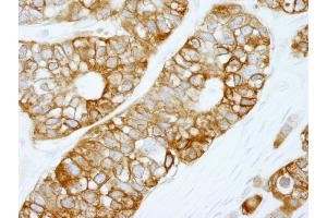 Immunohistochemistry (IHC) image for anti-Fatty Acid Synthase (FASN) (AA 2462-2511) antibody (ABIN7448964)